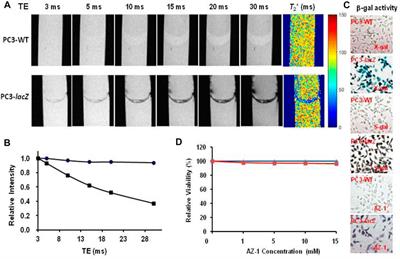 In Situ Generated Novel 1H MRI Reporter for β-Galactosidase Activity Detection and Visualization in Living Tumor Cells